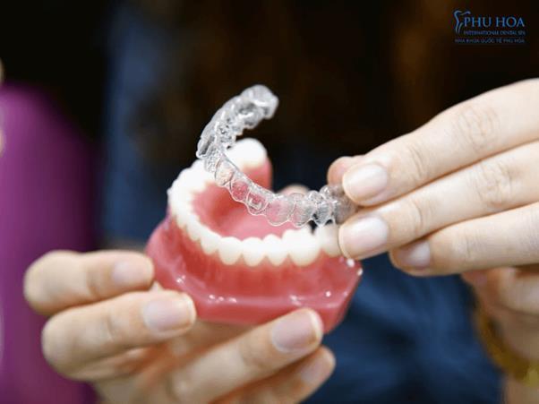 Tìm hiểu chung về công nghệ niềng răng Invisalign tiên tiến nhất hiện nay